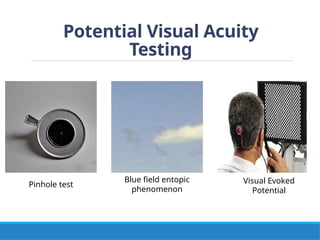 PROPERTIES OF LIGHT AND VISUAL FUNCTION.pptx
