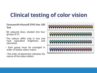 Clinical testing of color vision
Farnsworth-Munsell (FM) Hue 100
Test
•84 coloured discs, divided into four
groups of 21.
•The colours differ only in hue and
have equivalent brightness and
saturation.
• Each group must be arranged in
order of closest colour match.
• The order of placement indicates the
nature of the colour defect.
 
