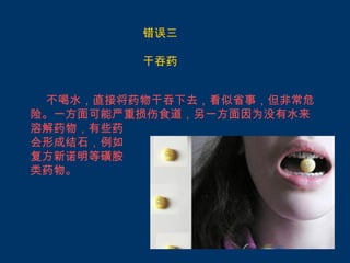 错误三

         干吞药


 不喝水，直接将药物干吞下去，看似省事，但非常危
险。一方面可能严重损伤食道，另一方面因为没有水来
溶解药物，有些药
会形成结石，例如
复方新诺明等磺胺
类药物。
 