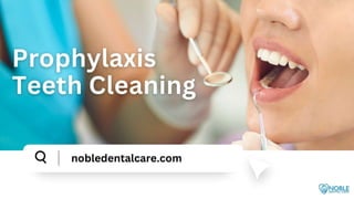 Prophylaxis Teeth Cleaning.pptx