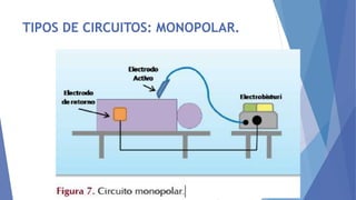 TIPOS DE CIRCUITOS: MONOPOLAR.
 