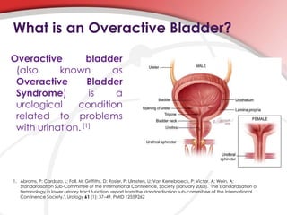 What is an Overactive Bladder?
Overactive bladder
(also known as
Overactive Bladder
Syndrome) is a
urological condition
related to problems
with urination. [1]
1. Abrams, P; Cardozo, L; Fall, M; Griffiths, D; Rosier, P; Ulmsten, U; Van Kerrebroeck, P; Victor, A; Wein, A;
Standardisation Sub-Committee of the International Continence, Society (January 2003). "The standardisation of
terminology in lower urinary tract function: report from the standardisation sub-committee of the International
Continence Society.". Urology 61 (1): 37–49. PMID 12559262
 