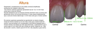 Geralmente, considerando-se uma média universal simplificada,
verificamos em relação à altura que:
Os incisivos Laterais superiores apresentam-se de 1.0 a 1.5 mm mais
curtos que a coroa do Central.
Quando desejamos que os Incisivos Centrais dominem mais no sorriso (isto
geralmente ocorre nos sorrisos femininos), é mais coesivo esteticamente
que a coroa do incisivo lateral seja 1.5 mm mais curta que o incisivo central.
Os caninos superiores apresentam-se geralmente na mesma margem
incisal do Incisivo Central ou 0.5 mm mais curtos que a borda incisal do
central. Leva-se também em consideração a dominância desejada para o
Incisivo Central. Se deseja que este seja dominante, o interessante é que o
canino seja 0.5 mm mais curto que a borda do central. Observar se o fato
de encurtar o canino, mesmo que em 0.5 mm, não prejudica a guia canina.
Altura= A - 1.0 a 1.5 mm
Altura= A
Altura= A ou - 0,5mm
Central Lateral Canino
Altura
 