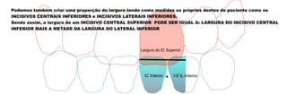 Largura do IC Superior
IC Inferior 1/2 IL Inferior
Podemos também criar uma proporção de largura tendo como medidas os próprios dentes do paciente como os
INCISIVOS CENTRAIS INFERIORES e INCISIVOS LATERAIS INFERIORES.
Sendo assim, a largura de um INCISIVO CENTRAL SUPERIOR PODE SER IGUAL A: LARGURA DO INCISIVO CENTRAL
INFERIOR MAIS A METADE DA LARGURA DO LATERAL INFERIOR
+
 