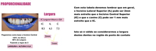 Com esta tabela devemos lembrar que em geral,
o Incisivo Lateral Superior (IL) pode ser 2mm
mais estreito que o Incisivo Central Superior
(IC) e que o canino (C) pode ser 1 mm mais
estreito que o IC.
Isto só é válido se considerarmos a largura
destes dentes na região do ponto de contato
 