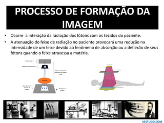 PROCESSO DE FORMAÇÃO DA
IMAGEM
• Ocorre a interação da radiação dos fótons com os tecidos do paciente.
• A atenuação do feixe de radiação no paciente provocará uma redução na
intensidade de um feixe devido ao fenômeno de absorção ou a deflexão de seus
fótons quando o feixe atravessa a matéria.
XESTUDO.COM
 