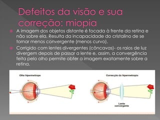  A imagem dos objetos distante é focada à frente da retina e
não sobre ela. Resulta da incapacidade do cristalino de se
tornar menos convergente (menos curvo).
 Corrigido com lentes divergentes (côncavas)- os raios de luz
divergem depois de passar a lente e, assim, a convergência
feita pelo olho permite obter a imagem exatamente sobre a
retina.
 
