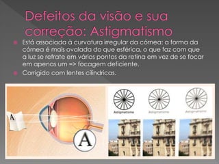  Está associada à curvatura irregular da córnea: a forma da
córnea é mais ovalada do que esférica, o que faz com que
a luz se refrate em vários pontos da retina em vez de se focar
em apenas um => focagem deficiente.
 Corrigido com lentes cílindricas.
 