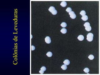 16Colônias de Leveduras