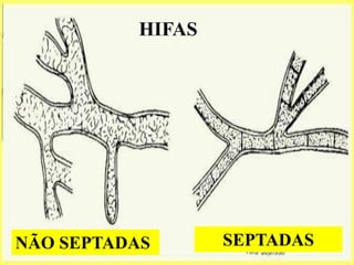 24HIFASSEPTADASNÃO SEPTADAS