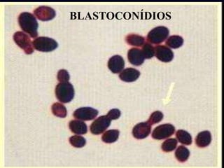 42BLASTOCONÍDIOS