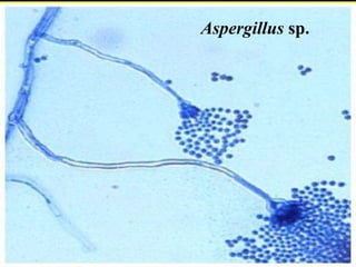 55Aspergillus sp.
