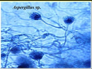 56Aspergillus sp.