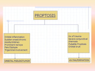 Proptosis
