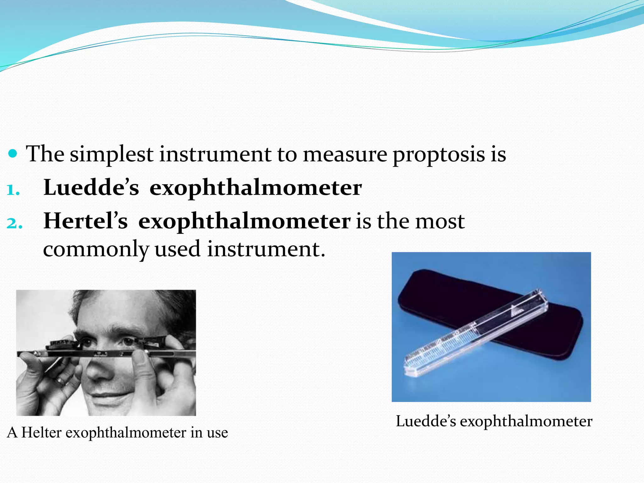 Proptosis | PPTX