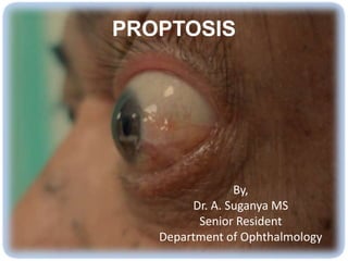 PROPTOSIS
By,
Dr. A. Suganya MS
Senior Resident
Department of Ophthalmology
 