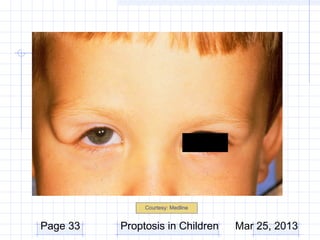 Courtesy: Medline


Page 33   Proptosis in Children    Mar 25, 2013
 