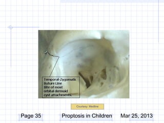 Courtesy: Medline


Page 35   Proptosis in Children     Mar 25, 2013
 