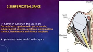 1.SUBPERIOSTEAL SPACE
 Common tumors in this space are
Dermoid cyst, epidermoid cyst,mucocele,
subperiosteal abscess, myeloma, osteomatous
tumour, haematoma and fibrous dysplasia
 plain x-rays most useful in this space
 