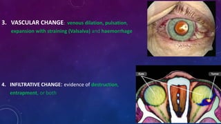 3. VASCULAR CHANGE: venous dilation, pulsation,
expansion with straining (Valsalva) and haemorrhage
4. INFILTRATIVE CHANGE: evidence of destruction,
entrapment, or both
 