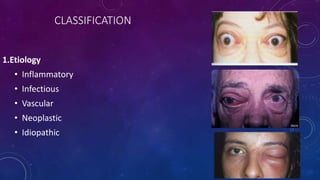 CLASSIFICATION
1.Etiology
• Inflammatory
• Infectious
• Vascular
• Neoplastic
• Idiopathic
 