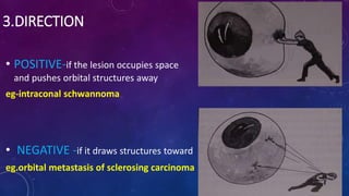3.DIRECTION
• POSITIVE-if the lesion occupies space
and pushes orbital structures away
eg-intraconal schwannoma
• NEGATIVE -if it draws structures toward
eg.orbital metastasis of sclerosing carcinoma
 