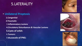 5.LATERALITY
• Unilateral Proptosis
1.Congenital
2.Traumatic
3.Inflammatory Lesions
4.Circulatory Disturbances & Vascular Lesions
5.Cysts of orbit:
6.Tumors:
7.Mucocele of PNS:
 