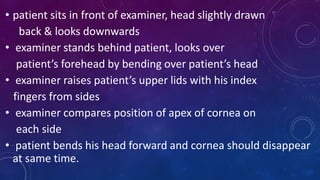 • patient sits in front of examiner, head slightly drawn
back & looks downwards
• examiner stands behind patient, looks over
patient’s forehead by bending over patient’s head
• examiner raises patient’s upper lids with his index
fingers from sides
• examiner compares position of apex of cornea on
each side
• patient bends his head forward and cornea should disappear
at same time.
 