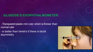 B)LUEDDE’S EXOPHTHALMOMETER:
-Transparent plastic mm ruler which is thicker than
normal ruler
- is better than hertel’s if there is facial
asymmetry
 