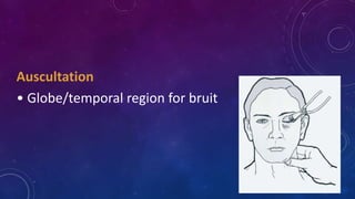 Auscultation
• Globe/temporal region for bruit
 