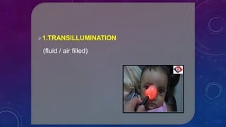 1.TRANSILLUMINATION
(fluid / air filled)
 