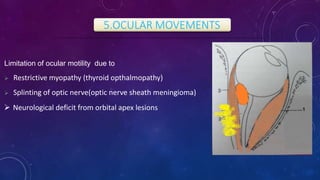 5.OCULAR MOVEMENTS
Limitation of ocular motility due to
 Restrictive myopathy (thyroid opthalmopathy)
 Splinting of optic nerve(optic nerve sheath meningioma)
 Neurological deficit from orbital apex lesions
 