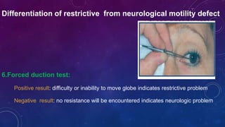 Differentiation of restrictive from neurological motility defect
6.Forced duction test:
Positive result: difficulty or inability to move globe indicates restrictive problem
Negative result: no resistance will be encountered indicates neurologic problem
 