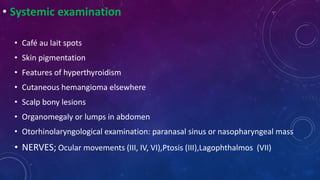 • Systemic examination
• Café au lait spots
• Skin pigmentation
• Features of hyperthyroidism
• Cutaneous hemangioma elsewhere
• Scalp bony lesions
• Organomegaly or lumps in abdomen
• Otorhinolaryngological examination: paranasal sinus or nasopharyngeal mass
• NERVES; Ocular movements (III, IV, VI),Ptosis (III),Lagophthalmos (VII)
 