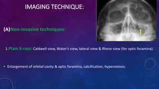 IMAGING TECHNIQUE:
(A)Non-invasive techniques:
1.Plain X-rays: Caldwell view, Water’s view, lateral view & Rhese view (for optic foramina).
• Enlargement of orbital cavity & optic foramina, calcification, hyperostosis.
 