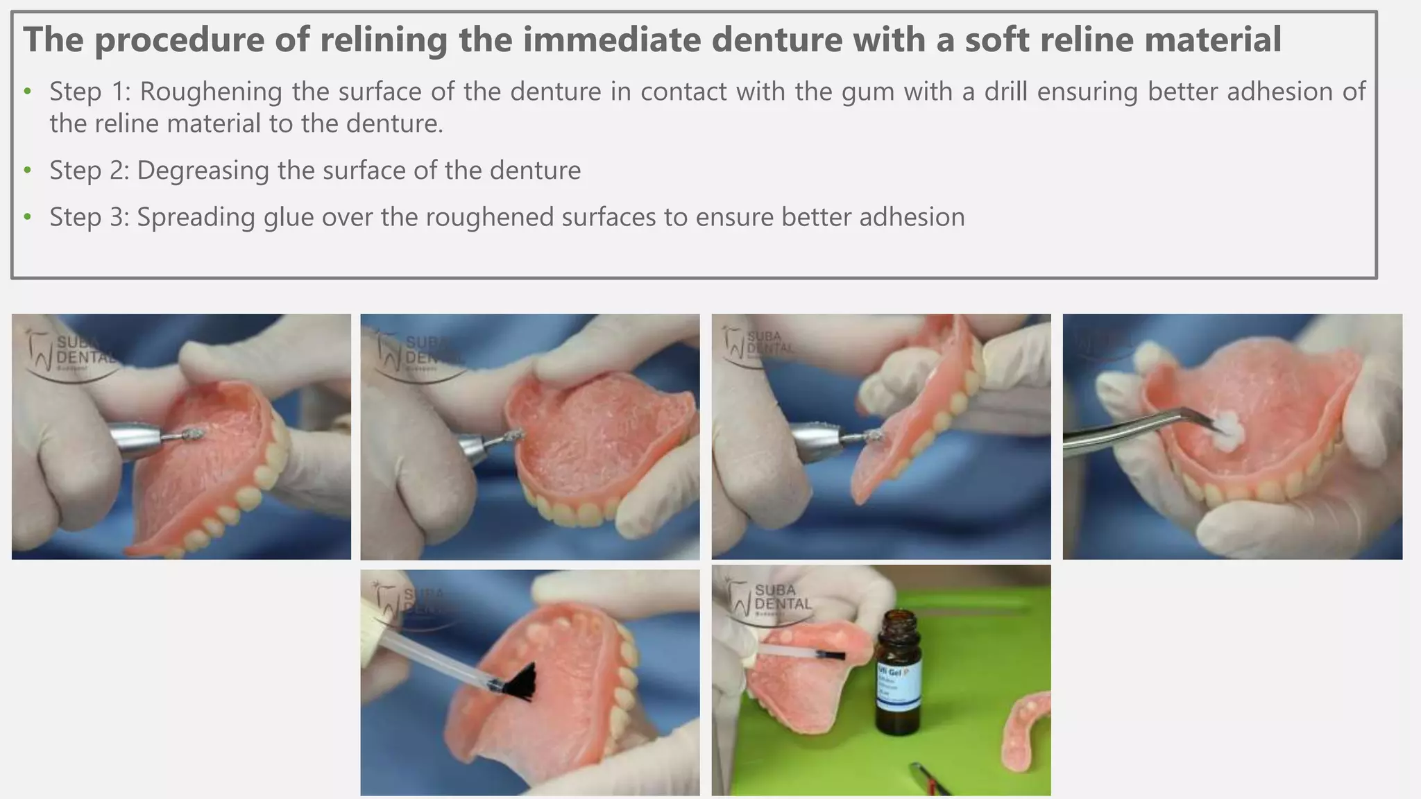 Reliance Dental Hard Chairside Reline Kit – Acrylic Rebase Repair For Dentures (4oz Liquid/Powder + Bonding)