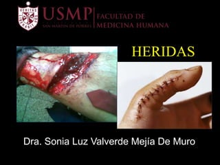 HERIDAS
Dra. Sonia Luz Valverde Mejía De Muro
 