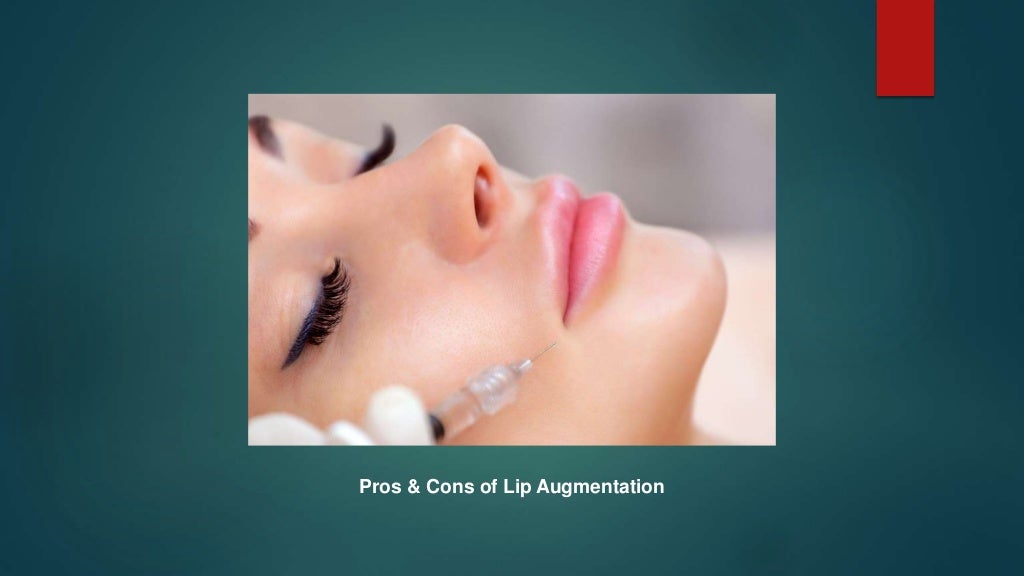 Pros & cons of lip augmentation