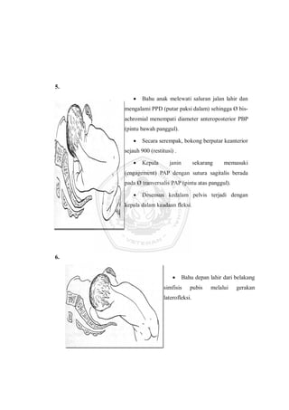 5.
 Bahu anak melewati saluran jalan lahir dan
mengalami PPD (putar paksi dalam) sehingga Ø bis-
achromial menempati diameter anteroposterior PBP
(pintu bawah panggul).
 Secara serempak, bokong berputar keanterior
sejauh 900 (restitusi) .
 Kepala janin sekarang memasuki
(engagement) PAP dengan sutura sagitalis berada
pada Ø tranversalis PAP (pintu atas panggul).
 Desensus kedalam pelvis terjadi dengan
kepala dalam keadaan fleksi.
6.
 Bahu depan lahir dari belakang
simfisis pubis melalui gerakan
laterofleksi.
 