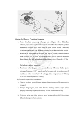 Gambar 5 : Manuver Persalinan Sungsang
 Anak dibiarkan tergantung beberapa saat didepan vulva. Dilakukan
tekanan pada daerah suprasimfisis untuk menambah fleksi kepala (bukan
mendorong fundus uteri). Bila tengkuk anak sudah terlihat, penolong
persalinan memegang kaki anak dan melakukan gerakan melingkar keatas.
 Manuver ini menggunakan referensi tepi bawah sacrum, menarik kepala
anak kebawah dan memutar melalui PBP (pintu bawah panggul) sehingga
dagu, hidung dan dahi nampak dan lahir didepan vulva (Gimovsky, 1995).
3 teknik persalinan sungsang :
1. Persalinan bahu dengan cara Lovset. Prinsip: Memutar badan janin
setengah lingkaran (180°) searah dan berlawanan arah jarum jam sambil
melakukan traksi curam kebawah sehingga bahu yang semula dibelakang
akan lahir didepan (dibawah simfsis).
Hal tersebut dapat terjadi oleh karena :
1. Adanya inklinasi panggul (sudut antara pintu atas panggul dengan sumbu
panggul)
2. Adanya lengkungan jalan lahir dimana dinding sebelah depan lebih
panjang dibanding lengkungan dinding sacrum disebelah belakang
3. Sehingga setiap saat bahu posterior akan berada pada posisi lebih rendah
dibandingkan posisi bahu anterior
 