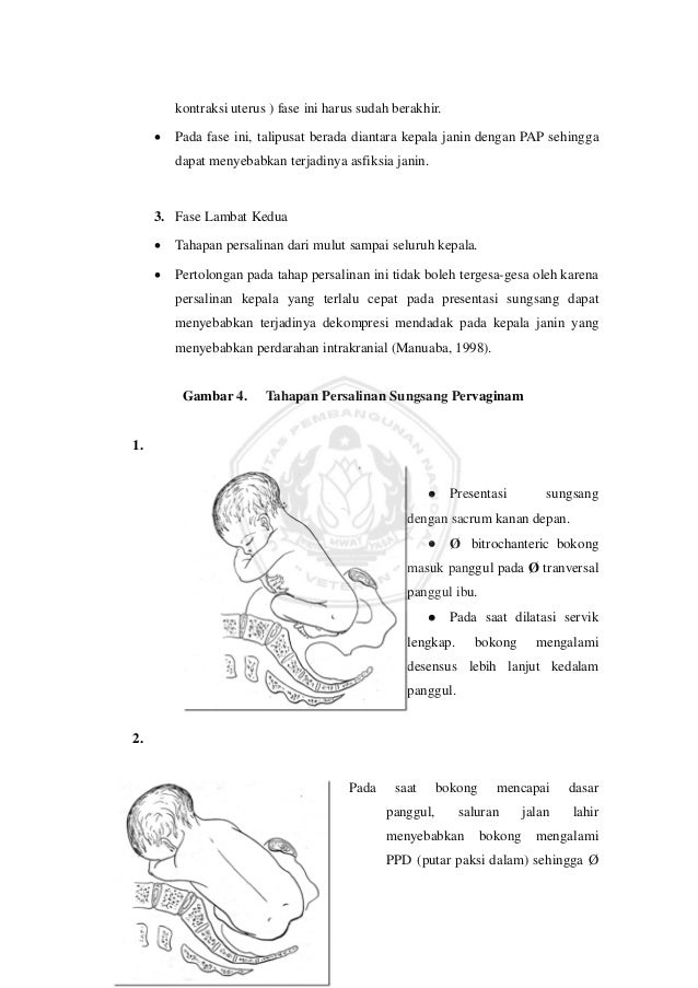 Proses persalinan Proses persalinan