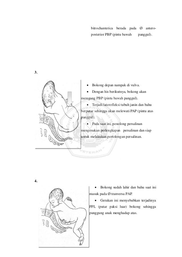 Proses persalinan Proses persalinan