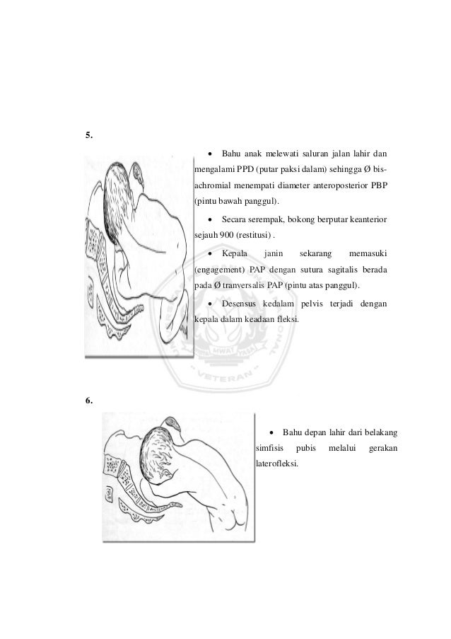 Proses persalinan Proses persalinan