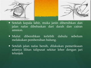  Setelah kepala lahir, muka janin dibersihkan dan
jalan nafas dibebaskan dari darah dan cairan
amnion.
 Mulut dibersihkan terlebih dahulu sebelum
melakukan pembersihan hidung.
 Setelah jalan nafas bersih, dilakukan pemeriksaan
adanya lilitan talipusat sekitar leher dengan jari
telunjuk
 