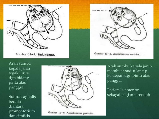 Proses persalinan normal