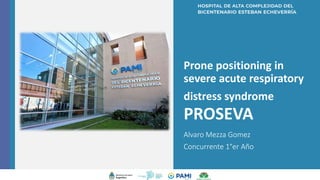 Prone positioning in
severe acute respiratory
distress syndrome
PROSEVA
Alvaro Mezza Gomez
Concurrente 1°er Año
v
 