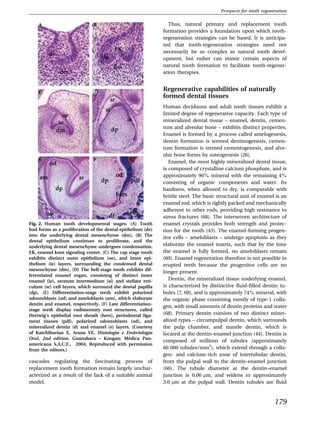 Prospects for tooth regeneration

                                                               Thus, natural primary and replacement tooth
                                                             formation provides a foundation upon which tooth-
                                                             regeneration strategies can be based. It is anticipa-
                                                             ted that tooth-regeneration strategies need not
                                                             necessarily be as complex as natural tooth devel-
                                                             opment, but rather can mimic certain aspects of
                                                             natural tooth formation to facilitate tooth-regener-
                                                             ation therapies.


                                                             Regenerative capabilities of naturally
                                                             formed dental tissues
                                                             Human deciduous and adult tooth tissues exhibit a
                                                             limited degree of regenerative capacity. Each type of
                                                             mineralized dental tissue – enamel, dentin, cemen-
                                                             tum and alveolar bone – exhibits distinct properties.
                                                             Enamel is formed by a process called amelogenesis,
                                                             dentin formation is termed dentinogenesis, cemen-
                                                             tum formation is termed cementogenesis, and alve-
                                                             olar bone forms by osteogenesis (26).
                                                                Enamel, the most highly mineralized dental tissue,
                                                             is composed of crystalline calcium phosphate, and is
                                                             approximately 96% mineral with the remaining 4%
                                                             consisting of organic components and water. Its
                                                             hardness, when allowed to dry, is comparable with
                                                             brittle steel. The basic structural unit of enamel is an
                                                             enamel rod, which is tightly packed and mechanically
                                                             adherent to other rods, providing high resistance to
                                                             stress fractures (68). The interwoven architecture of
Fig. 2. Human tooth developmental stages. (A) Tooth          enamel crystals provides both strength and protec-
bud forms as a proliferation of the dental epithelium (de)   tion for the tooth (43). The enamel-forming progen-
into the underlying dental mesenchyme (dm). (B) The
                                                             itor cells – ameloblasts – undergo apoptosis as they
dental epithelium continues to proliferate, and the
underlying dental mesenchyme undergoes condensation.         elaborate the enamel matrix, such that by the time
EK, enamel knot signaling center. (C) The cap stage tooth    the enamel is fully formed, no ameloblasts remain
exhibits distinct outer epithelium (oe), and inner epi-      (60). Enamel regeneration therefore is not possible in
thelium (ie) layers, surrounding the condensed dental        erupted teeth because the progenitor cells are no
mesenchyme (dm). (D) The bell-stage tooth exhibits dif-
                                                             longer present.
ferentiated enamel organ, consisting of distinct inner
enamel (ie), stratum intermedium (si) and stellate reti-        Dentin, the mineralized tissue underlying enamel,
culum (sr) cell layers, which surround the dental papilla    is characterized by distinctive ﬂuid-ﬁlled dentin tu-
(dp). (E) Differentiation-stage teeth exhibit polarized      bules (7, 68), and is approximately 74% mineral, with
odontoblasts (od) and ameloblasts (am), which elaborate      the organic phase consisting mostly of type-1 colla-
dentin and enamel, respectively. (F) Late differentiation-
                                                             gen, with small amounts of dentin proteins and water
stage teeth display rudimentary root structures, called
Hertwig’s epithelial root sheath (hers), periodontal liga-   (68). Primary dentin consists of two distinct miner-
ment tissues (pdl), polarized odontoblasts (od), and         alized types – circumpulpal dentin, which surrounds
mineralized dentin (d) and enamel (e) layers. (Courtesy      the pulp chamber, and mantle dentin, which is
of Katchiburian E, Arana VE. Histologia e Embriologia        located at the dentin–enamel junction (44). Dentin is
                                               ´
Oral, 2nd edition. Guanabara – Koogan: Medica Pan-
                                                             composed of millions of tubules (approximately
americana S.A.C.F., 2004. Reproduced with permission
from the editors.)                                           60 000 tubules/mm2), which extend through a colla-
                                                             gen- and calcium-rich zone of intertubular dentin,
cascades regulating the fascinating process of               from the pulpal wall to the dentin–enamel junction
replacement tooth formation remain largely unchar-           (66). The tubule diameter at the dentin–enamel
acterized as a result of the lack of a suitable animal       junction is 0.06 lm, and widens to approximately
model.                                                       3.0 lm at the pulpal wall. Dentin tubules are ﬂuid



                                                                                                                 179
 