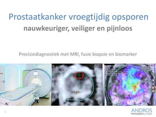 Prostaatkanker vroegtijdig opsporen
1
nauwkeuriger, veiliger en pijnloos
Precisiediagnostiek met MRI, fusie biopsie en biomarker
 
