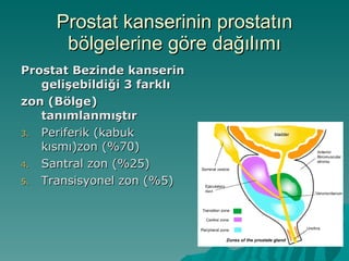 Prostat kanserinin prostatın bölgelerine göre dağılımı Prostat Bezinde kanserin gelişebildiği 3 farklı  zon (Bölge) tanımlanmıştır Periferik (kabuk kısmı)zon (%70) Santral zon (%25) Transisyonel zon (%5) 