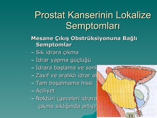 Prostat Kanserinin Lokalize Semptomları Mesane Çıkış Obstrüksiyonuna Bağlı Semptomlar Sık idrara çıkma İdrar yapma güçlüğü İdrara başlama ve sonlandırmada güçlük Zayıf ve aralıklı idrar akışı Tam boşalmama hissi Aciliyet Noktüri (geceleri idrara çıkma sıklığında artış) 